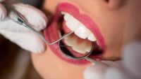How To Identify Teeth Issues