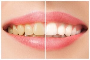 dental services